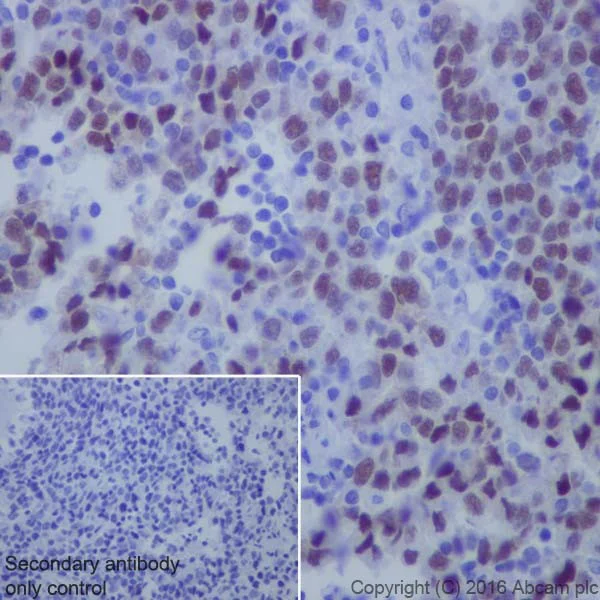 Immunohistochemistry (Formalin/PFA-fixed paraffin-embedded sections) - Anti-KLF4 antibody [EPR19590] (AB215036)