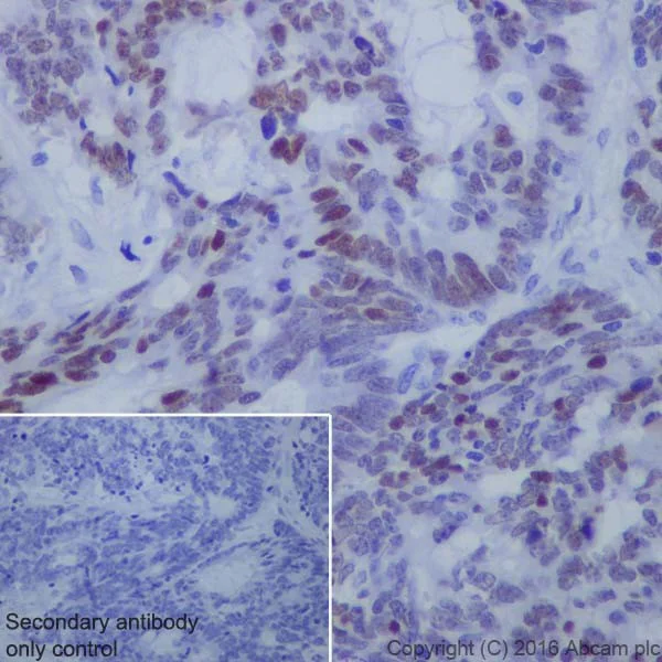 Immunohistochemistry (Formalin/PFA-fixed paraffin-embedded sections) - Anti-KLF4 antibody [EPR19590] (AB215036)
