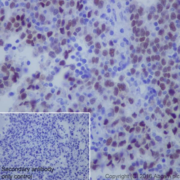 Immunohistochemistry (Formalin/PFA-fixed paraffin-embedded sections) - Anti-KLF4 antibody [EPR19590] - BSA and Azide free (ab222235), expandable thumbnail
