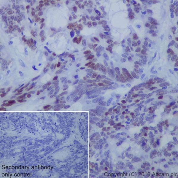 Immunohistochemistry (Formalin/PFA-fixed paraffin-embedded sections) - Anti-KLF4 antibody [EPR19590] - BSA and Azide free (AB222235), expandable thumbnail