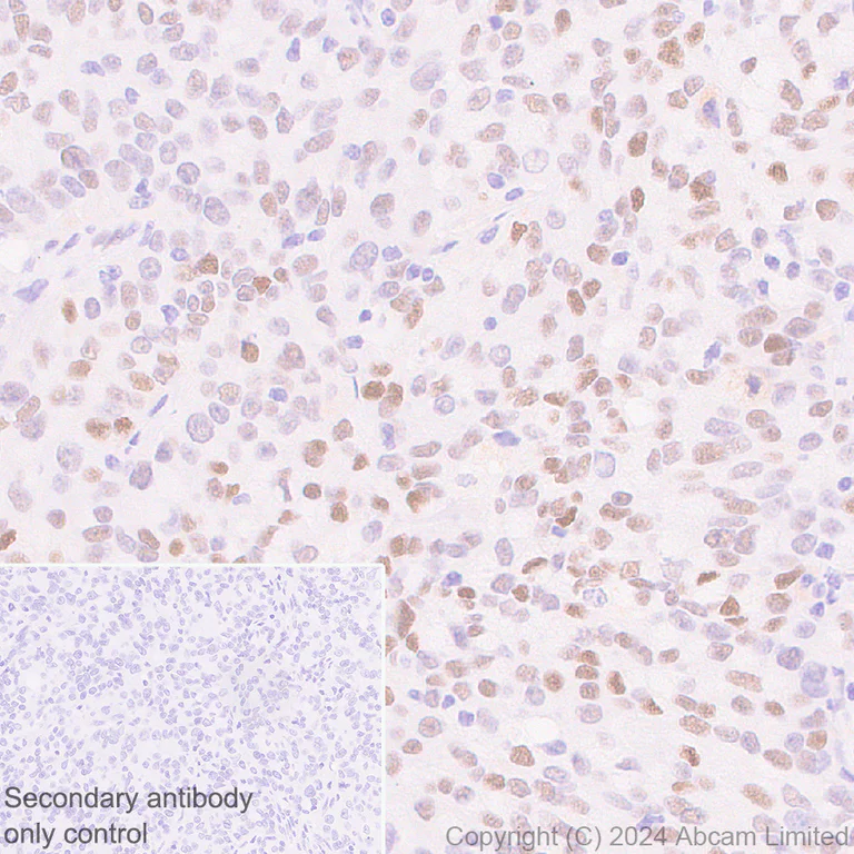 Immunohistochemistry (Formalin/PFA-fixed paraffin-embedded sections) - Anti-KLF4 antibody [RM1174] (AB322110)