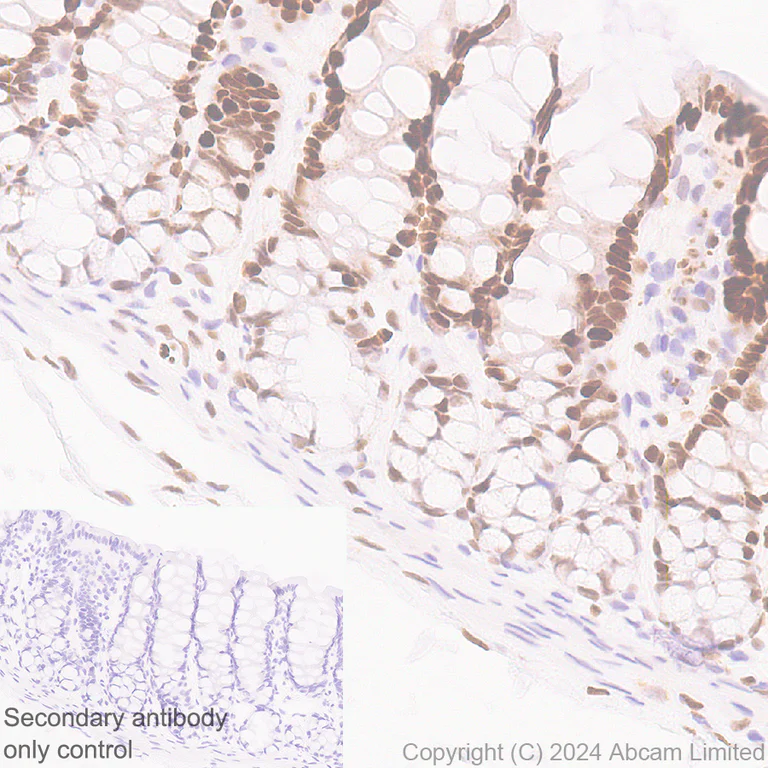 Immunohistochemistry (Formalin/PFA-fixed paraffin-embedded sections) - Anti-KLF4 antibody [RM1174] (AB322110)