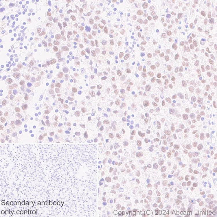 Immunohistochemistry (Formalin/PFA-fixed paraffin-embedded sections) - Anti-KLF4 antibody [RM1174] (AB322110)