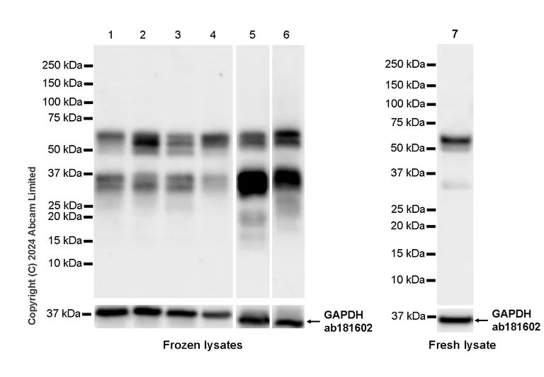 Western blot - Anti-KLF4 antibody [RM1174] (AB322110)