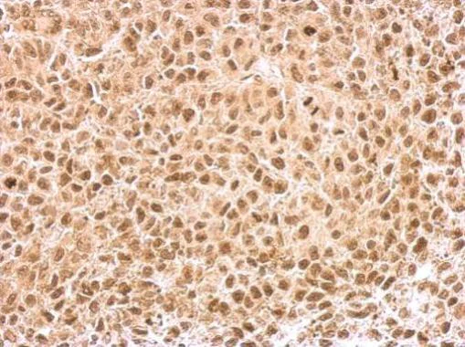 Immunohistochemistry (Formalin/PFA-fixed paraffin-embedded sections) - Anti-KLF5 antibody (AB137676)