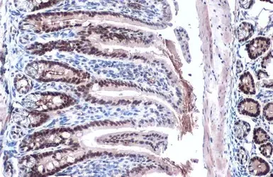 Immunohistochemistry (Formalin/PFA-fixed paraffin-embedded sections) - Anti-KLF5 antibody (AB137676)