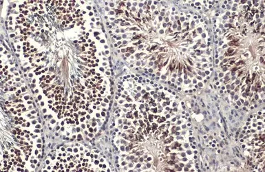 Immunohistochemistry (Formalin/PFA-fixed paraffin-embedded sections) - Anti-KLF5 antibody (AB137676)