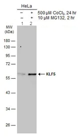 Western blot - Anti-KLF5 antibody (AB137676)