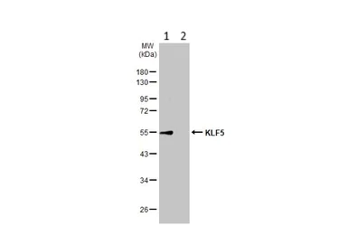 Western blot - Anti-KLF5 antibody (AB137676)