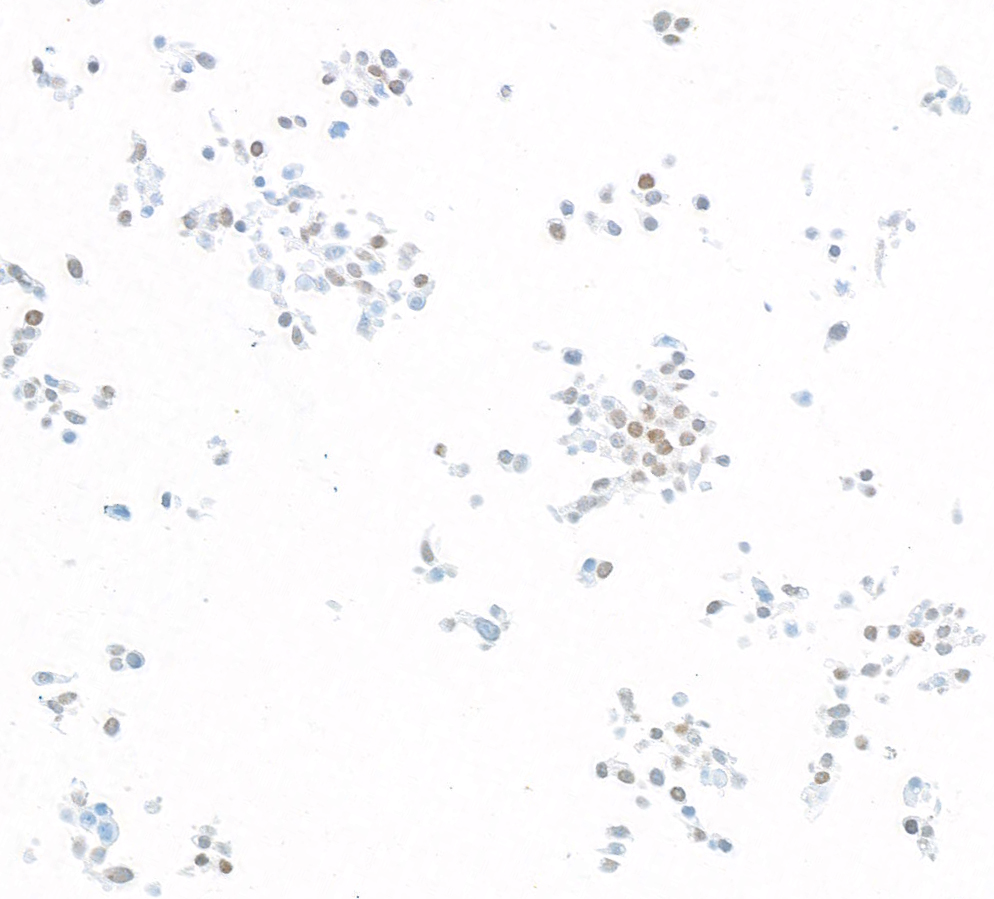 Immunocytochemistry - Anti-KLF5 antibody [BLR243L] - BSA free (ab314109), expandable thumbnail