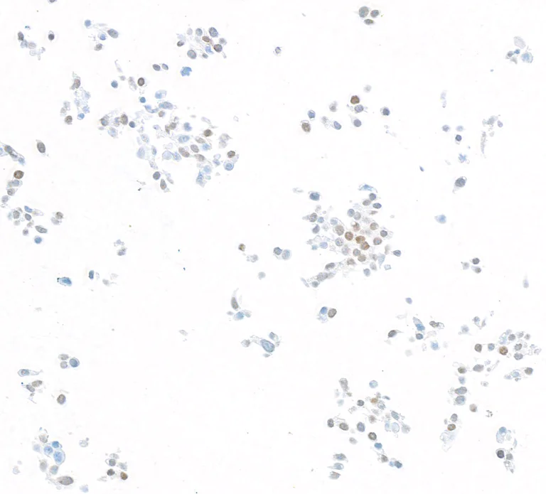 Immunocytochemistry - Anti-KLF5 antibody [BLR243L] - BSA free (AB314109)