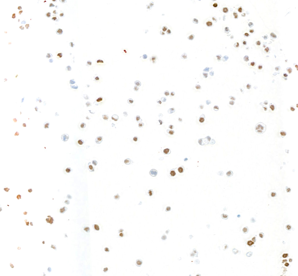 Immunocytochemistry - Anti-KLF5 antibody [BLR243L] - BSA free (ab314109), expandable thumbnail