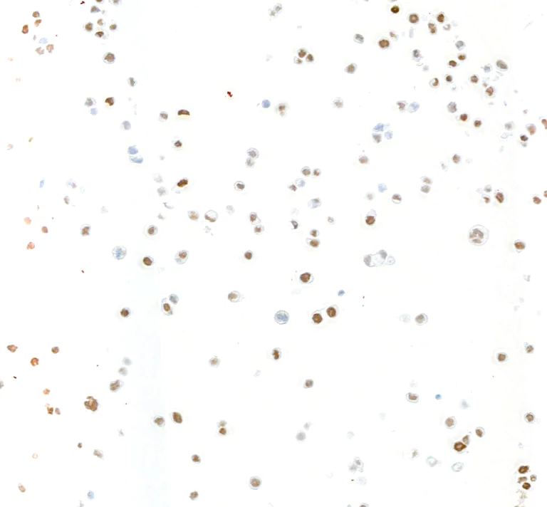 Immunocytochemistry - Anti-KLF5 antibody [BLR243L] - BSA free (AB314109)