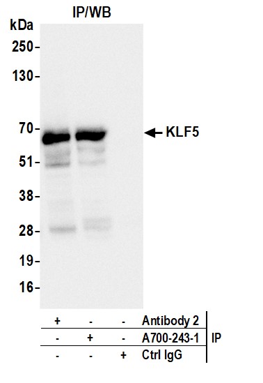Immunoprecipitation - Anti-KLF5 antibody [BLR243L] - BSA free (AB314109), expandable thumbnail