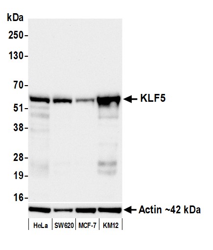 Western blot - Anti-KLF5 antibody [BLR243L] - BSA free (AB314109), expandable thumbnail