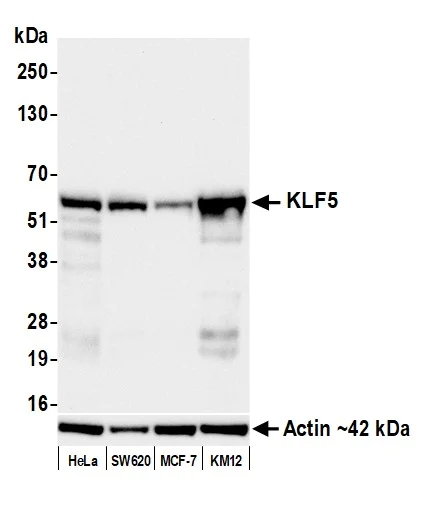 Western blot - Anti-KLF5 antibody [BLR243L] - BSA free (AB314109)
