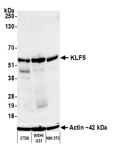 Western blot - Anti-KLF5 antibody [BLR243L] - BSA free (AB314109), expandable thumbnail