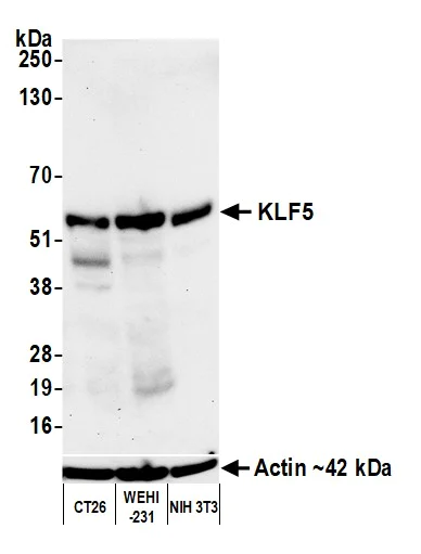 Western blot - Anti-KLF5 antibody [BLR243L] - BSA free (AB314109)