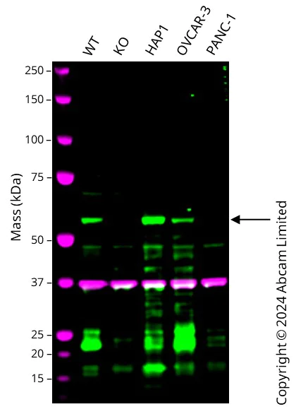 Western blot - Anti-KLF5 antibody [BLR243L] - BSA free (AB314109)