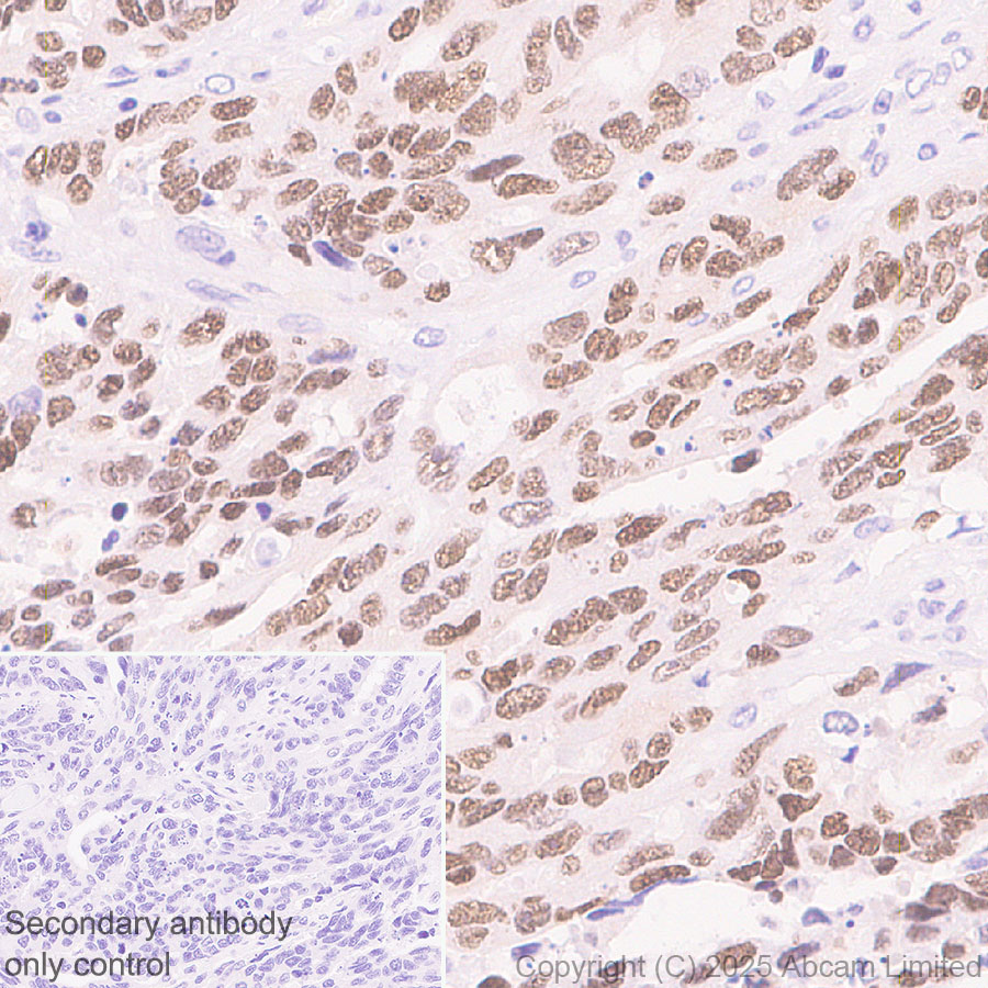 Immunohistochemistry (Formalin/PFA-fixed paraffin-embedded sections) - Anti-KLF5 antibody [EPR29066-77] (ab324105), expandable thumbnail