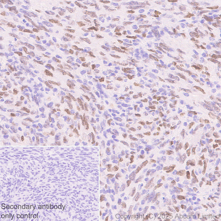 Immunohistochemistry (Formalin/PFA-fixed paraffin-embedded sections) - Anti-KLF5 antibody [EPR29066-77] (ab324105), expandable thumbnail