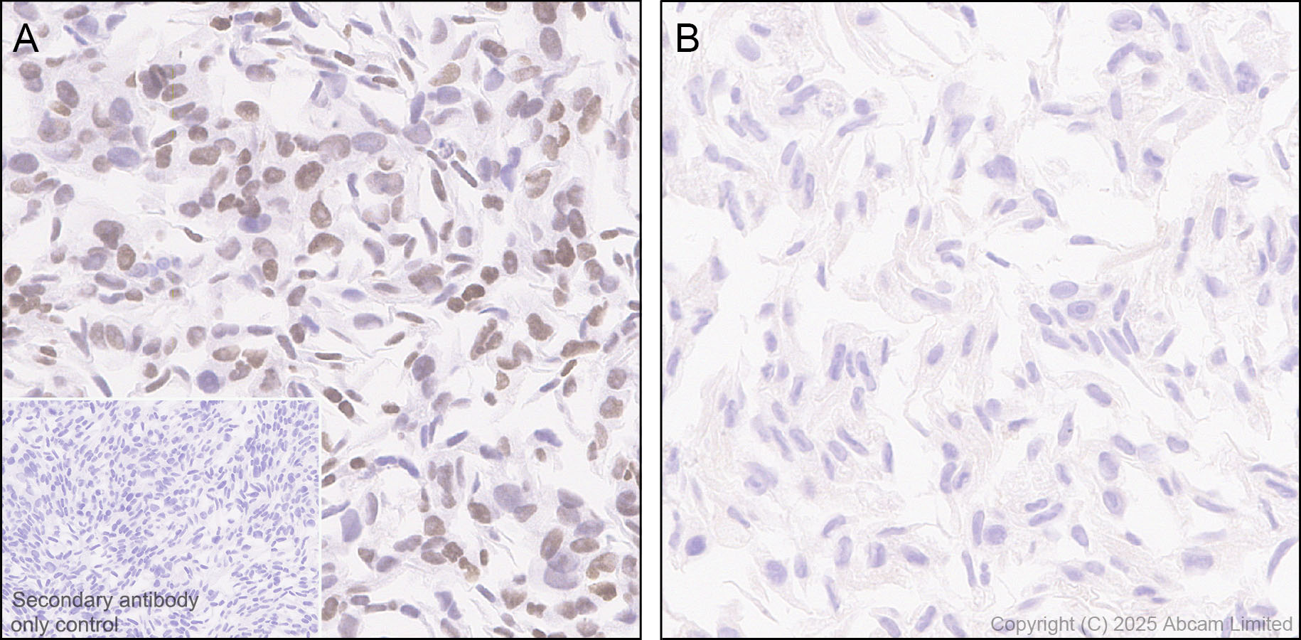 Immunohistochemistry (Formalin/PFA-fixed paraffin-embedded sections) - Anti-KLF5 antibody [EPR29066-77] (AB324105), expandable thumbnail