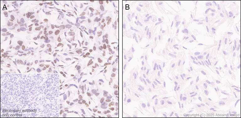 Immunohistochemistry (Formalin/PFA-fixed paraffin-embedded sections) - Anti-KLF5 antibody [EPR29066-77] (AB324105)