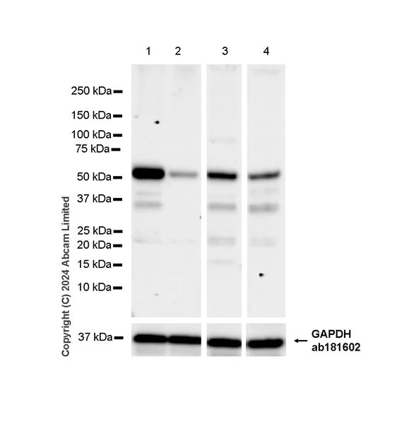 Western blot - Anti-KLF5 antibody [EPR29066-77] (AB324105)