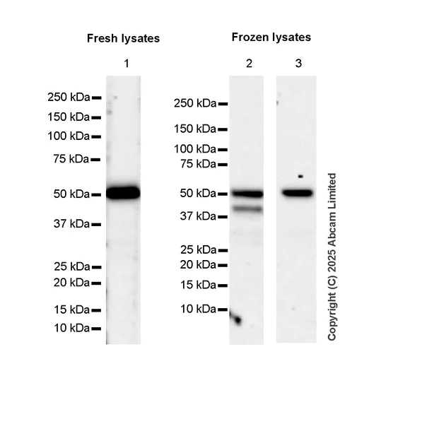 Western blot - Anti-KLF5 antibody [EPR29066-77] (AB324105)