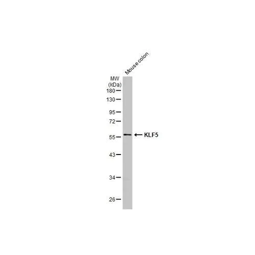 Western blot - Anti-KLF5 antibody [HL2269] (AB317184)