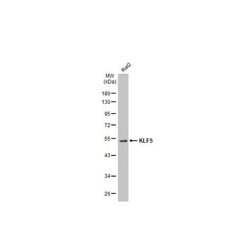 Western blot - Anti-KLF5 antibody [HL2269] (AB317184)