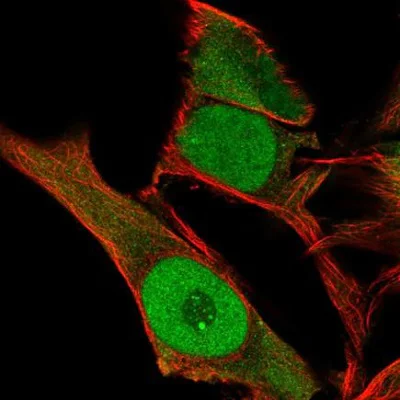 Immunocytochemistry/ Immunofluorescence - Anti-KLF6 antibody (AB241385)