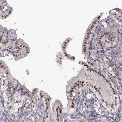 Immunohistochemistry (Formalin/PFA-fixed paraffin-embedded sections) - Anti-KLF6 antibody (AB241385)