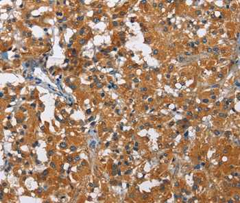 Immunohistochemistry (Formalin/PFA-fixed paraffin-embedded sections) - Anti-KLF7 antibody (AB197690), expandable thumbnail