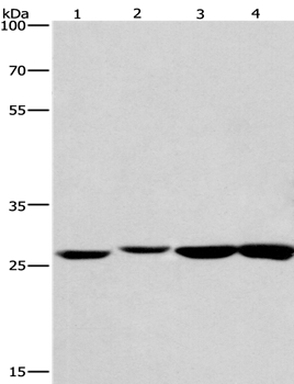 Western blot - Anti-KLF7 antibody (AB197690), expandable thumbnail