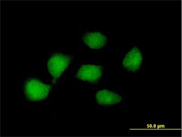Immunocytochemistry/ Immunofluorescence - Anti-KLF8 antibody (AB168527)