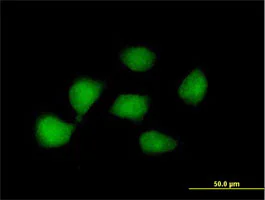 Immunocytochemistry/ Immunofluorescence - Anti-KLF8 antibody (AB168527)
