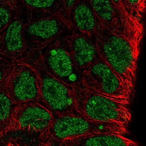 Immunocytochemistry/ Immunofluorescence - Anti-KLF8 antibody (AB221867)