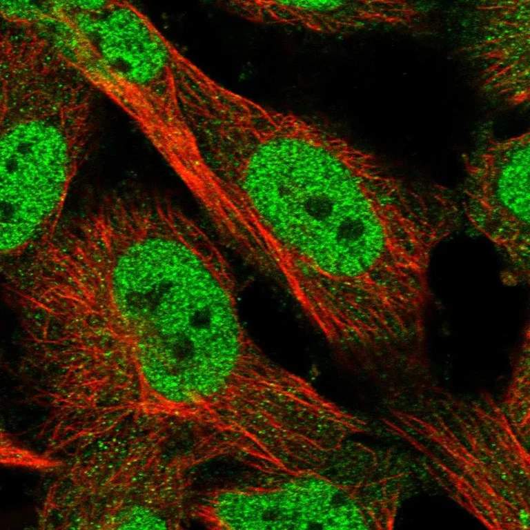 Immunocytochemistry/ Immunofluorescence - Anti-KLHDC3 antibody (AB272605)
