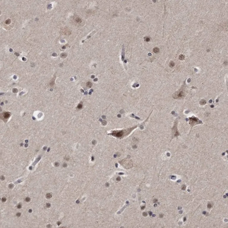 Immunohistochemistry (Formalin/PFA-fixed paraffin-embedded sections) - Anti-KLHDC3 antibody (AB272605)
