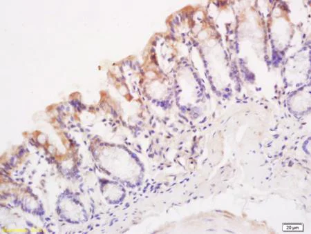 Immunohistochemistry (Formalin/PFA-fixed paraffin-embedded sections) - Anti-KLHL12 antibody (AB203880)