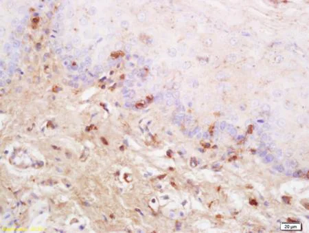 Immunohistochemistry (Formalin/PFA-fixed paraffin-embedded sections) - Anti-KLHL12 antibody (AB203880)