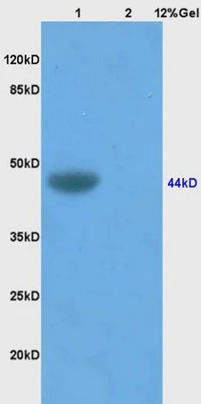 Western blot - Anti-KLHL12 antibody (AB203880)