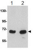 Western blot - Anti-KLHL15 antibody (AB113906), expandable thumbnail
