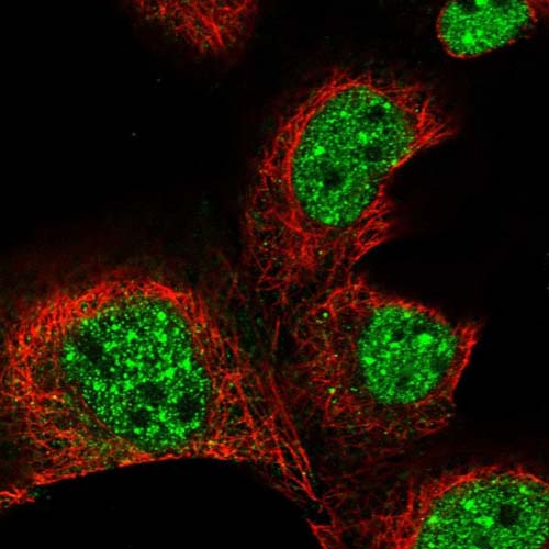 Immunocytochemistry/ Immunofluorescence - Anti-KLHL17 antibody (AB122164), expandable thumbnail