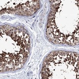 Immunohistochemistry (Formalin/PFA-fixed paraffin-embedded sections) - Anti-KLHL17 antibody (AB122164), expandable thumbnail