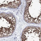 Immunohistochemistry (Formalin/PFA-fixed paraffin-embedded sections) - Anti-KLHL17 antibody (AB122164)