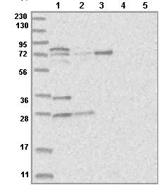 Western blot - Anti-KLHL17 antibody (AB122164)