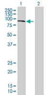 Western blot - Anti-KLHL20 antibody (AB67682)