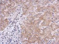 Immunohistochemistry (Formalin/PFA-fixed paraffin-embedded sections) - Anti-KLHL21 antibody (AB111604)